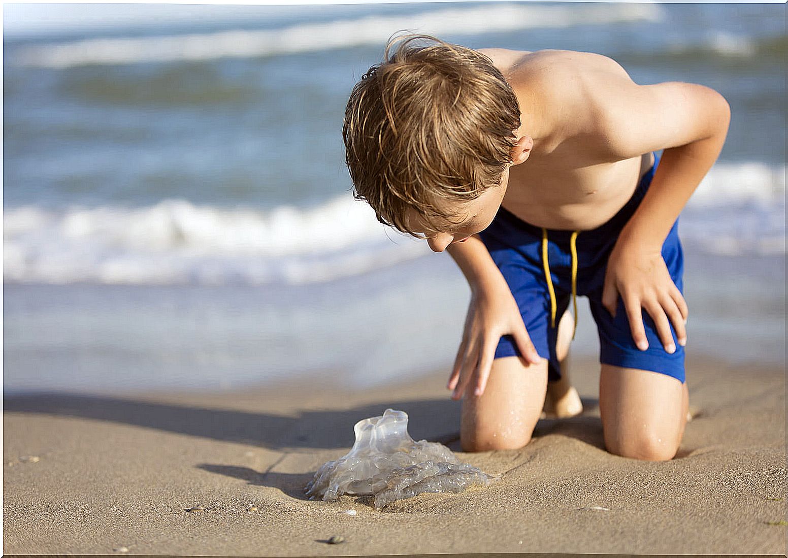 Jellyfish stings in children