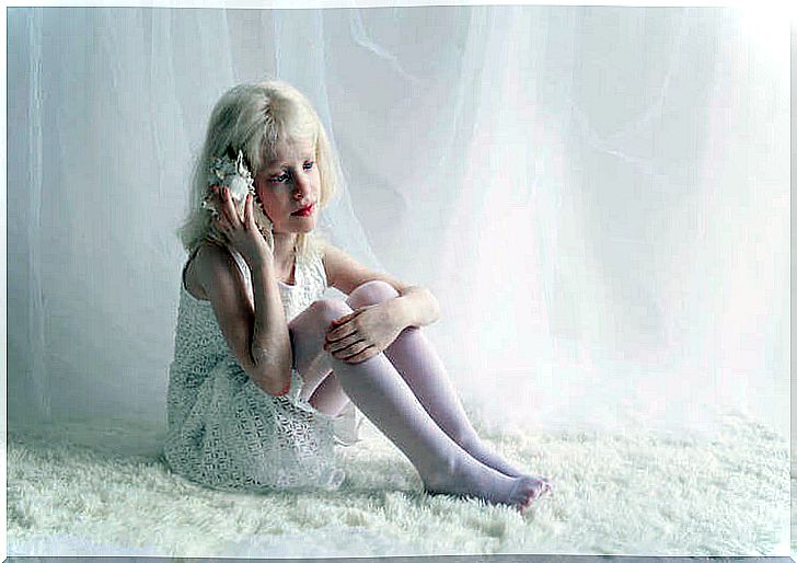 Albinism in children.