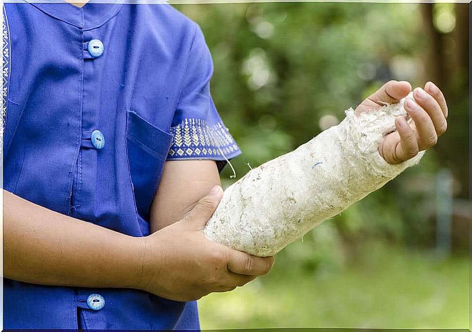 Child with arm in cast due to sports injury and with possible signs of infantile osteoarthritis.